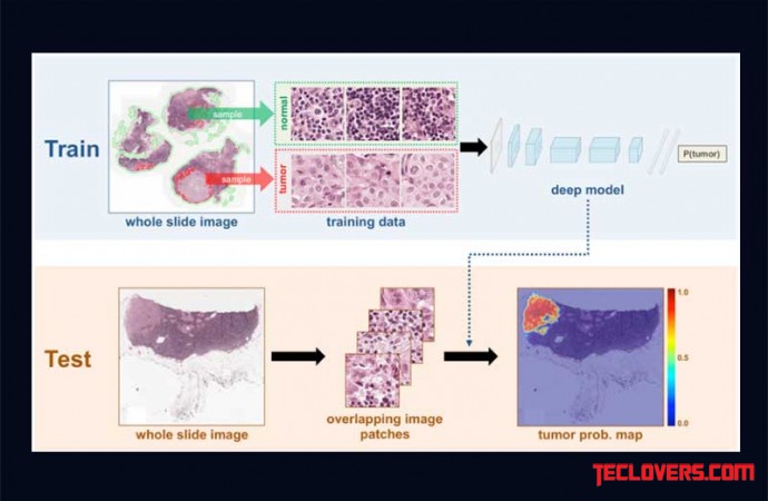 Deep Learning System deteksi kanker payudara dengan akurasi 92 persen